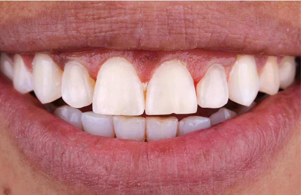 Ortodonti - 2